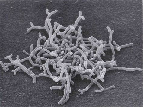 Bifidobacterium Longum Alchetron The Free Social Encyclopedia