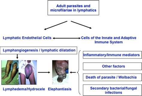 Insights Into The Pathogenesis Of Disease In Human Lymphatic Filariasis