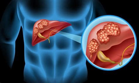 How To Care For Your Liver Debunking The Popular And Harmful Liver