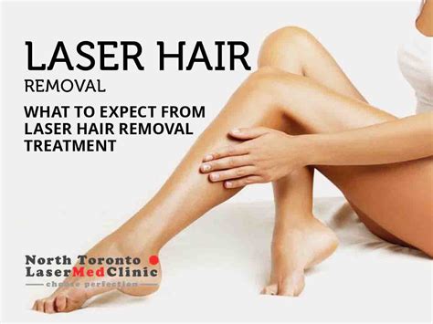 What To Expect From Laser Hair Removal Treatment North Toronto Laser
