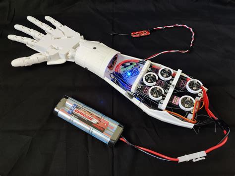 Designing A 3d Printed Emg Bionic Hand As A Low Cost Alternative To