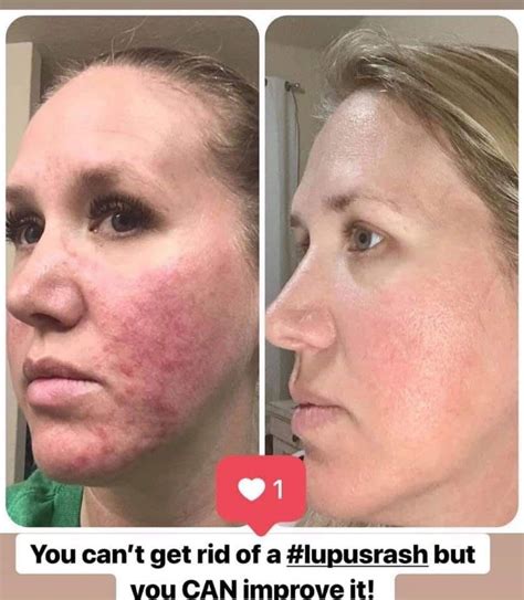 Pin On Thrive Before And After