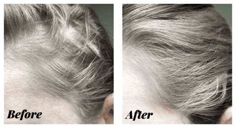 Kiierr Hair Loss Treatment Blog Tips And Tricks For Healthy Hair