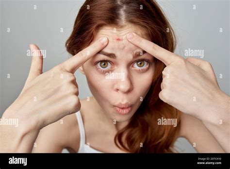 Woman Squeezes Pimple On Her Forehead Skin Problems Cosmetology Stock