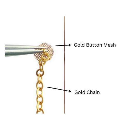 Gold Chain Bonding For Buried Teeth Tes Clinic For Face And Jaw