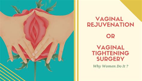 About Vaginal Rejuvenation Or Vaginal Tightening Surgery What Are The Risk Fectors