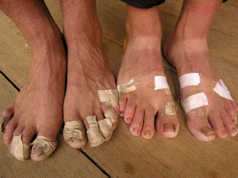 Distance Running Foot Care