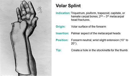 SplintER Series Common ED Splint Techniques Splint Principles