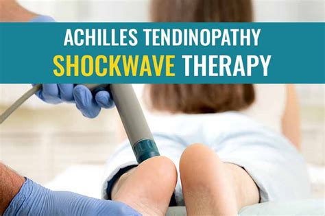 Shockwave Treatment For Achilles Tendinopathy Treat My Achilles