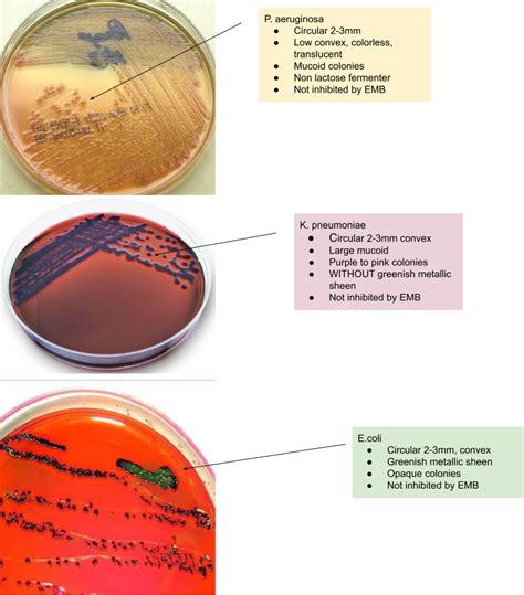 Solved Illustrate In An Agar Plate How Each Microbes S Aureus P