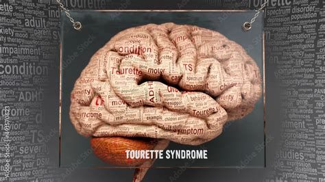 Stockillustratie Tourette Syndrome Anatomy Its Causes And Effects