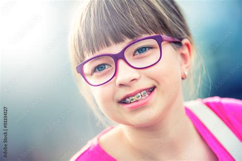 Girl Teen Pre Teen Girl With Glasses Girl With Teeth Braces Young