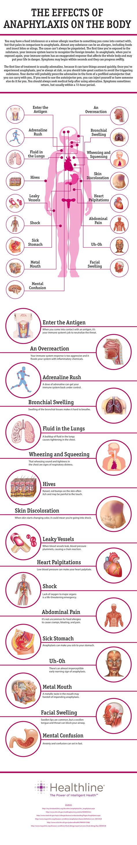 17 Effects Of Anaphylaxis On The Body