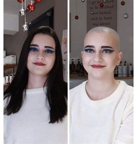 bald women balding