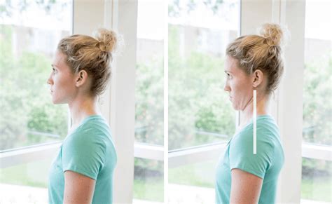 Correct Forward Head Posture How To Improve Your Posture And Reduce