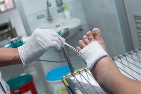 Diabetic Foot Care Treatment And Prevention In Boca Raton Fl