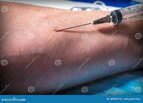 The Injection Of A Drug Into The Patientâ€ S Arm With A Syringe Needle