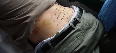 Check spelling or type a new query. Rückenschmerzen Archives - Seite 2 von 2 - Naturheilpraxis ...