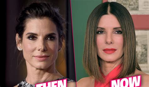 sandra bullock frozen face result of fillers and botox overload docs claim