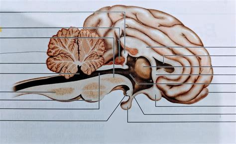 Midsagittal Sheep Brain Diagram Quizlet
