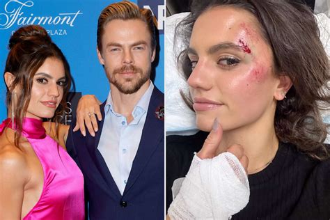 Derek Hough And Hayley Erbert Were Involved In A Scary Car Accident