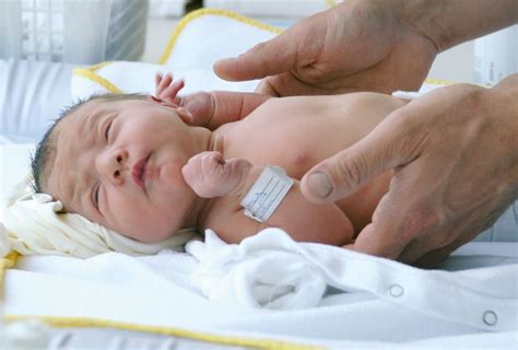 Sepsis neonatal qué es causas diagnóstico tratamiento y más