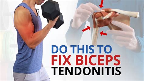 4 Unique Exercises To Fix Biceps Tendonitis Dont Stretch Youtube