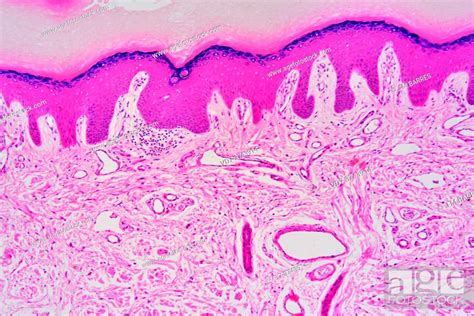 Human Skin With Epidermis And Dermis With Sweat Gland Photomicrograph