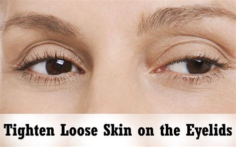 Natural Ways To Tighten Loose Skin On Eyelids Must Try