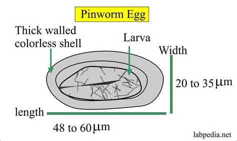 Enterobius Vermicularis Pinworms Thread Worm Diagnosis And Treatment