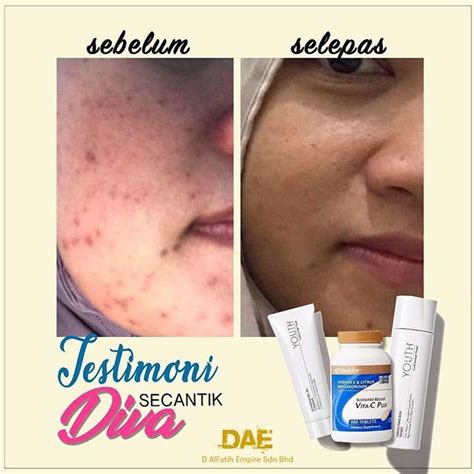 Tapi itulah nak katanya, kolagen berkurang pun boleh jadi faktor pori besar. Produk Skincare Untuk Mengecilkan Liang Pori Kulit Muka ...