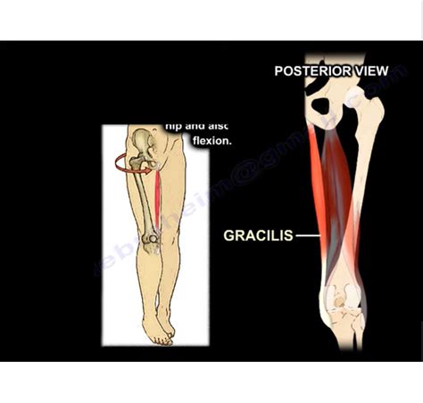 Hamstrings And Sciatic Nerve Relationship —