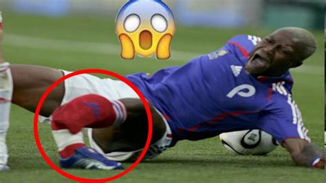 Top 10 Ugliest Soccer Injuries Youtube
