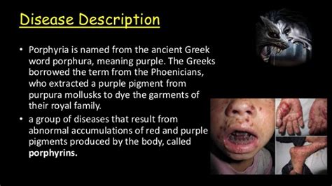 Know Everything About Porphyria