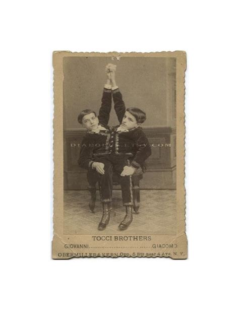 1890 Photo Of Conjoined Siamese Twins Circus And Sideshow Freaks Sideshow Freaks Human