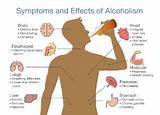 List Of Side Effects Of Alcohol Images
