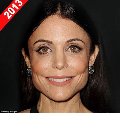 Real Housewives Bethenny Frankel Reveals She Gets Botox In Her Jaw