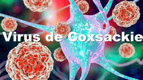 Virus De Coxsackie Qué Es Características Síntomas Y Más Escena Informativa Tlaxcala