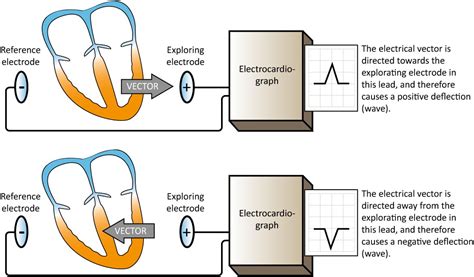 Cardiac Electrophysiology Action Potential Automaticity And Vectors