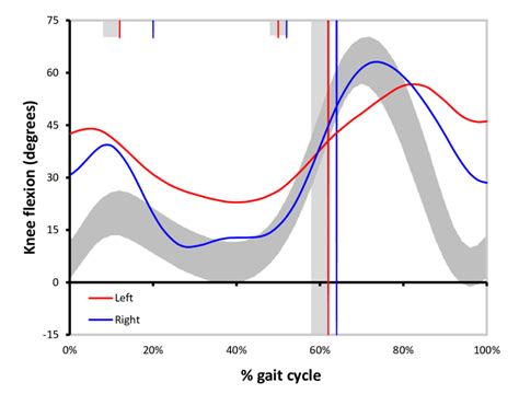 A Standard Gait Graph The Curves Represent How A Single Gait Variable