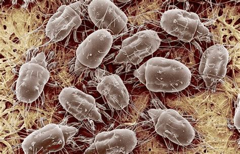 5 Facts You Should Know About The Dust Mites In Your Home Xl Cleaners