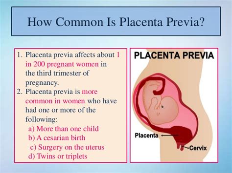 As your pregnancy progresses, your placenta is likely. Placenta Previa- Symptoms, Causes & Treatment