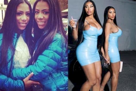 Clermont Twins Before And After Buttocks Cheek Chin And Lips Surgery