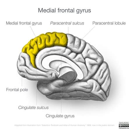Medial Frontal Gyrus Radiology Reference Article Radiopaedia Org