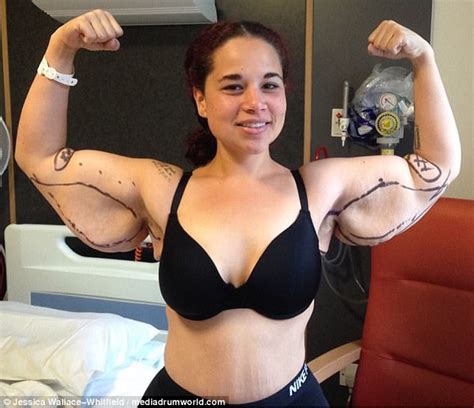 Woman Who Lost Lbs Raising Money For Loose Skin Surgery Daily Mail