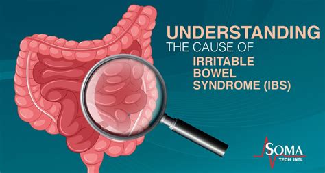 Understanding The Cause Of Irritable Bowel Syndrome IBS TW McIsaac Health Systems Inc