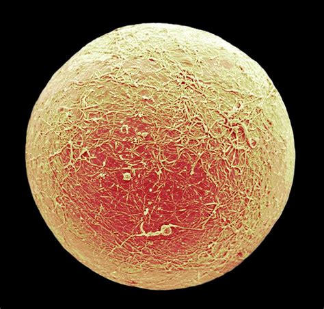 Fat Cell Photograph By Steve Gschmeissnerscience Photo Library Pixels