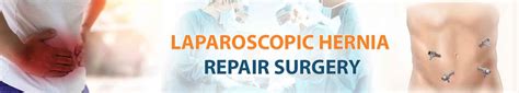 Laparoscopic Hernia Repair Surgery India Surgery Tours India