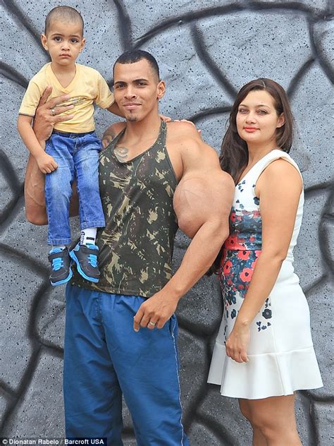 Bodybuilder Romario Dos Santos Alves Risks His Life By Injecting Oil Into His Biceps Daily