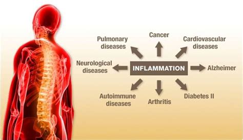 Why Does Inflammation Lead To Disease Gene Smart